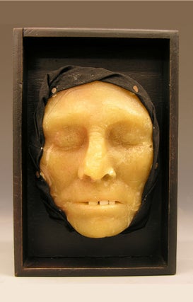 19th c. Wax Anatomical Model, Jaundice