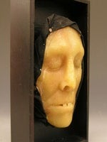 19th c. Wax Anatomical Model, Jaundice